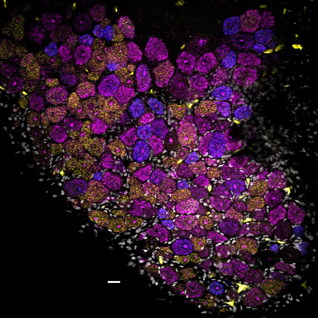 Microscopy showing lots of purple and pink circles