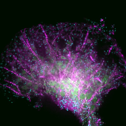 Microscopy showing a tree-shaped structure